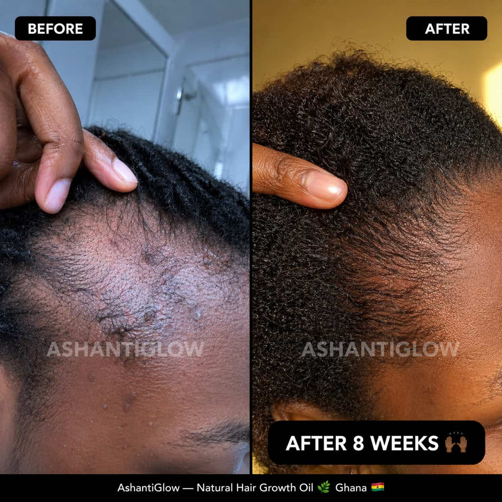 Natural Hair Growth Oil — Regrow Your Edges in 30 Days