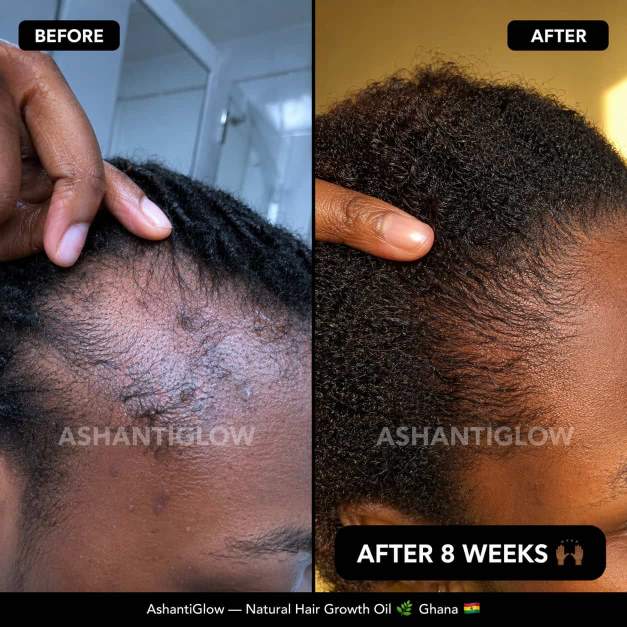 Natural Hair Growth Oil — Regrow Your Edges in 30 Days