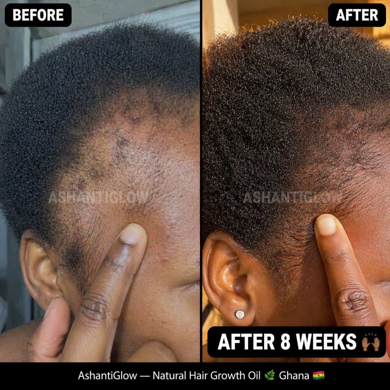 Natural Hair Growth Oil — Regrow Your Edges in 30 Days