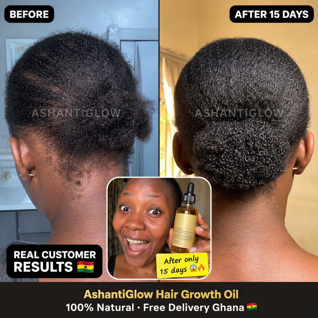 Natural Hair Growth Oil — Regrow Your Edges in 30 Days