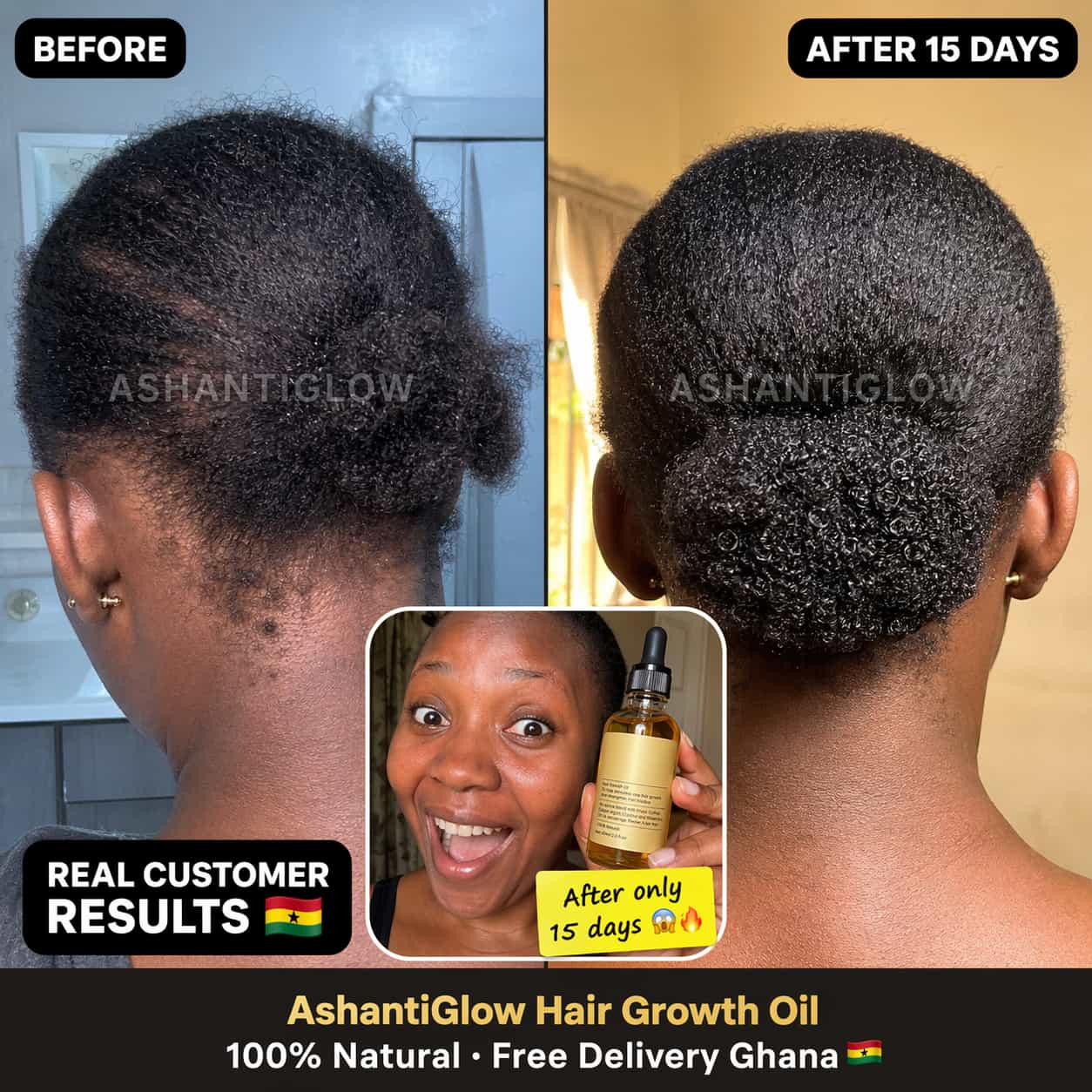 Natural Hair Growth Oil — Regrow Your Edges in 30 Days