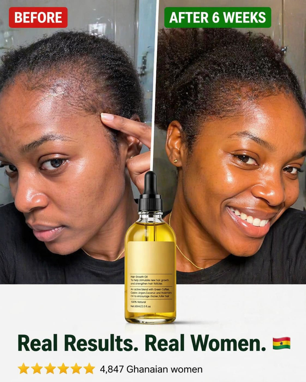 Natural Hair Growth Oil — Regrow Your Edges in 30 Days